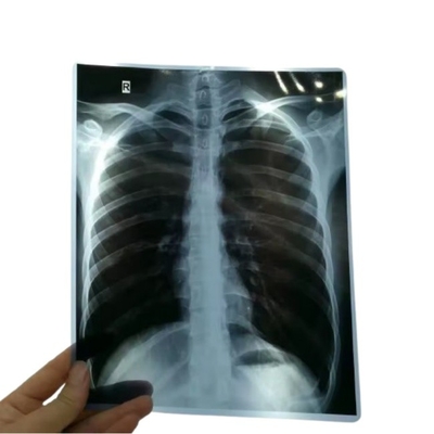 14*17 polegadas de filme de varredura seca de raios X/CT/DR para impressora de imagem a laser de raios X e equipamento de impressora de imagem térmica