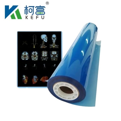 Dimensão personalizada Filme médico de raios X de jato de tinta azul branco para impressoras de jato de tinta em folhas