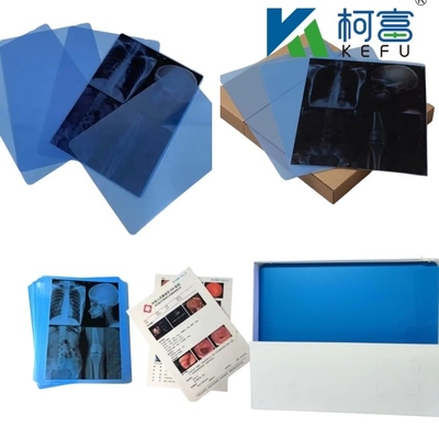 Dimensão personalizada Filme médico de raios X de jato de tinta azul branco para impressoras de jato de tinta em folhas