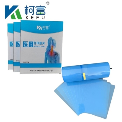 Imagem Médica Seca PET Inkjet Filme Azul Filme Médico de Raios X Tamanho Personalizado