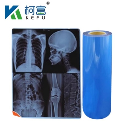 Filme térmico médico à prova d'água de raios X Filme azul de raios X para impressoras a jato de tinta