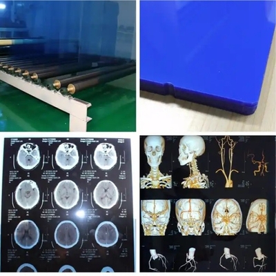 Filme térmico médico à prova d'água de raios X Filme azul de raios X para impressoras a jato de tinta