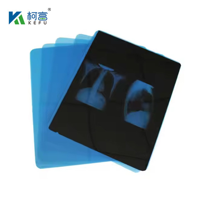 China Grátis Folha de laminagem de plástico transparente resistente aos raios UV