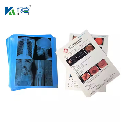 Película de laser médico com alta precisão de cores e fidelidade 14x18in 0.16mm para imagens de diagnóstico reais à vida