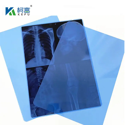 10*12in Filme de varredura a seco para raios-X/CT/DR Médico Impressora de imagem a laser de raios-X E Equipamento de impressora de imagem térmica