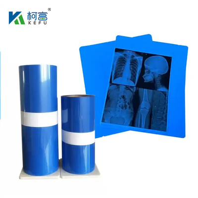 Impressão por jato de tinta de raios X Medicina Filme de impressão por jato de tinta seco de raios X para dispositivos médicos Venda direta de fábrica