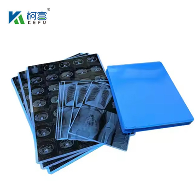 Último Design Film de Raio-X Seco Médico Personalizado de 8 * 10 polegadas Para Impressoras Inkjet