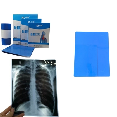 Folhas de tamanho A4 Filtro de jato de tinta azul de raios X para impressão de imagem médica Raios X CT CR DR MTR PET