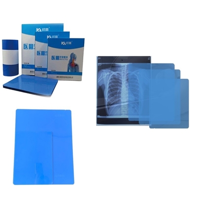 Amostra grátis Imagem de filme de papel de jato de tinta de raios X Impressa por impressora Para diagnóstico médico de radiologia Impressora 8 * 10