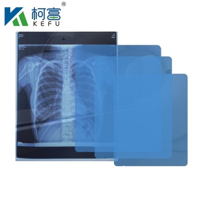 8x10 10x12 10x14 14x17 polegadas de DiHL secos Filme Médico Laser Xray Filme para Clínica e Hospitais