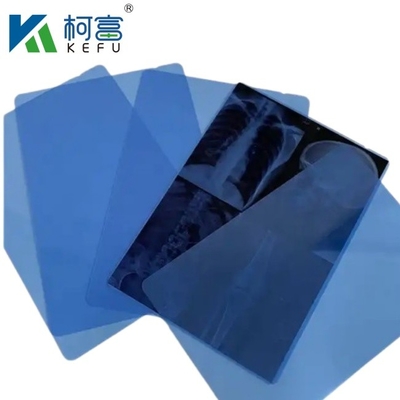 Impressão a jato de tinta de filme azul de raios X 8'*10' folha PET de jato de tinta de filme azul de filme médico de raios X seco