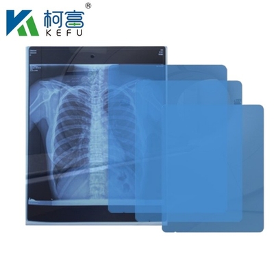 Tamanho personalizado Filme médico de raios X Azul Filme médico sensível de raios X Filme médico a jato de tinta