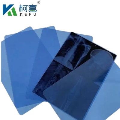 Tamanho personalizado Filme médico de raios X Azul Filme médico sensível de raios X Filme médico a jato de tinta