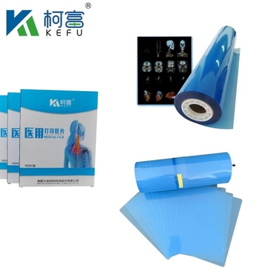 Filme de jato de tinta azul para radiografia médica/CT/DR Filme de varredura seca para impressora de imagem a laser de raios-X e equipamento de impressora de imagem térmica