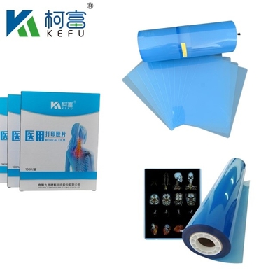 Filme de impressão por jato de tinta médico Produção profissional Filme de raios X azul médico Impressão a laser Filme de raios X médico