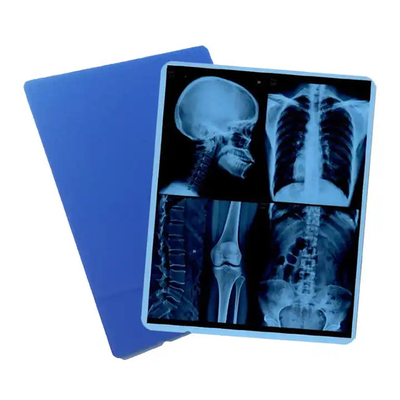 Introdução de filmes de plástico PET de raios-X para fins médicos de 125 micrões.