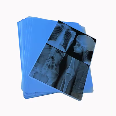 A nossa película de raios X azul médica produzida profissionalmente para impressão a laser é a escolha ideal.