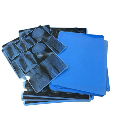 Filme de raios X azul médico para diagnóstico preciso de impressão a laser