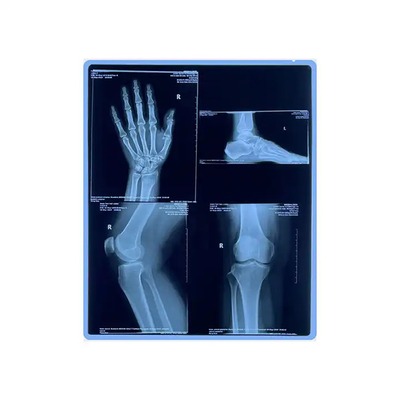 11*14 Tamanho de filme médico de raios X azul para impressão a laser