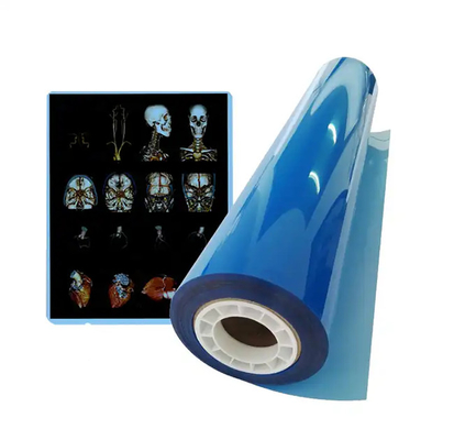 11*14 Tamanho de filme médico de raios X azul para impressão a laser