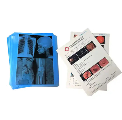 Filme de raios X azul médico para impressão a laser de artigos de consumo hospitalares médicos