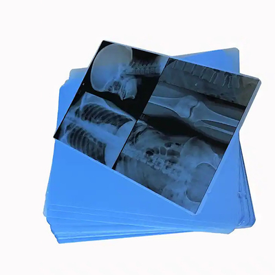 Filme de raios X azul médico para impressão a laser de artigos de consumo hospitalares médicos