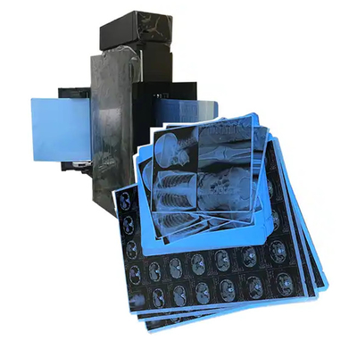 Filme de raios X azul médico para impressão a laser de artigos de consumo hospitalares médicos