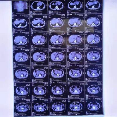 Custo razoável Filmes de raios-X médicos com alta estabilidade de imagem que fornecem imagens de diagnóstico médico claras e precisas