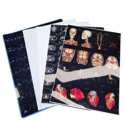 Filmes de raios-X médicos de alta resolução azul-branco com acabamento de superfície brilhante