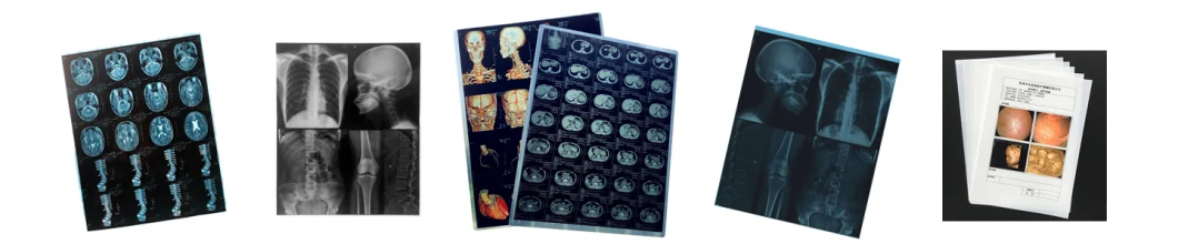 11X14 Inch Medical X-ray Film/Analogue Medical Film/Dry Film