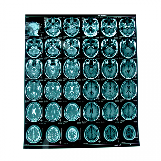 Filme de raios X Médico A4 ou em rolos 0