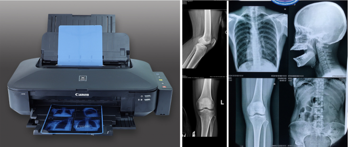 Filme de raios X Médico Termal Seco Para Impressora 3